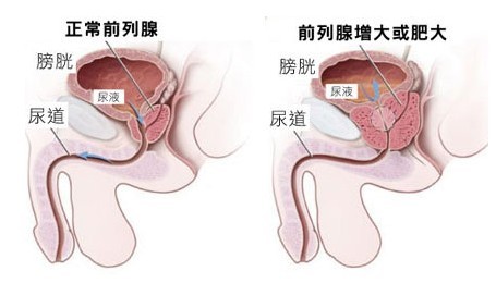 卵巢囊肿的消失时间与多种因素相关，一般几个月至几年不等